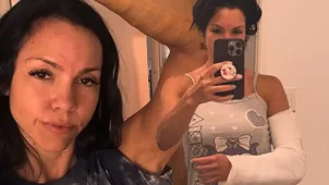 Paloma Fiuza sufrió terrible accidente: "La lesión más dolorosa"