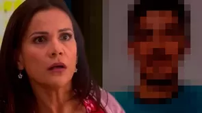 Al Fondo Hay Sitio: Charito quedó horrorizada al ver cómo quedó Jimmy después de la operación de cara