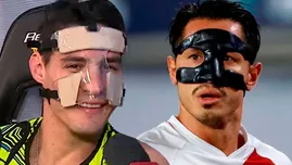 Facundo González regresó a EEG con un curioso protector facial para recuperarse.